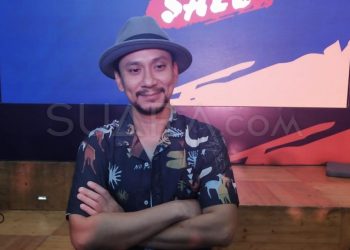 Vincent Rompies Akui Pernah Operasi Plastik, Bagian Apa yang Diubah?