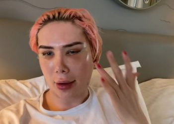 Terobsesi Jadi Jimin BTS, Bule Inggris Operasi Mata dan Ngaku Jadi Orang Korea