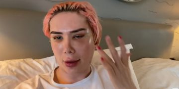 Terobsesi Jadi Jimin BTS, Bule Inggris Operasi Mata dan Ngaku Jadi Orang Korea