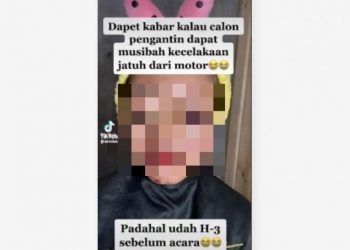 MUA Rias Pengantin Habis Kecelakaan Lukanya Belum Kering, Tak Disangka Hasilnya Memukau