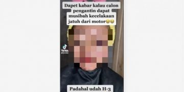MUA Rias Pengantin Habis Kecelakaan Lukanya Belum Kering, Tak Disangka Hasilnya Memukau