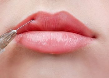 Filler bibir